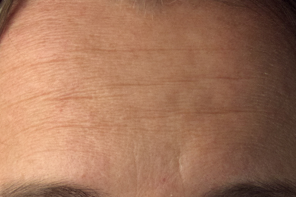 Pat David Mairi Headshot Forehead Closeup Wavelet Decompose Frequency Separation